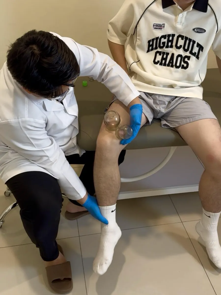 中医师为患者膝盖周边进行拔罐治疗