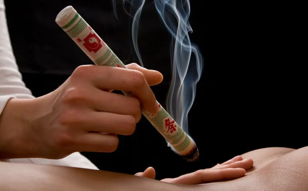 艾灸 Moxibustion